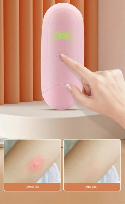 Reliever Bites - Insect Mosquito Bite Relief Cream